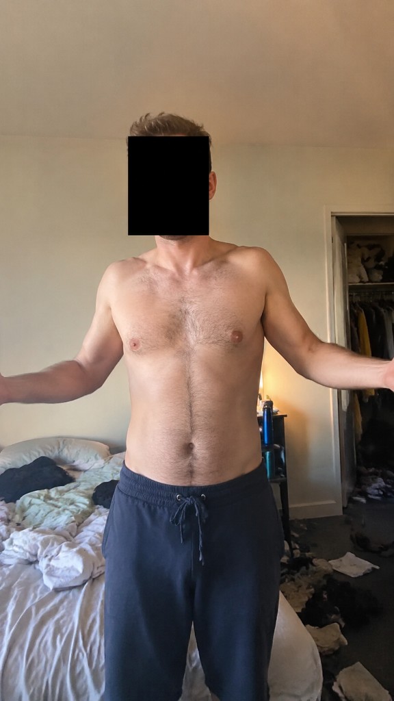 Our intern, face redacted, shirtless with arms out. The tattoo goes on his body.